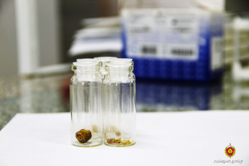 Болезнь легче предупредить, чем лечить: как избежать мочекаменной болезни